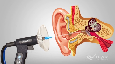 Earigator